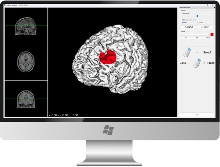 MRI Guided Navigation