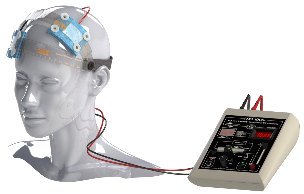 High Definition-Electroconvulsive Therapy – Soterix Medical