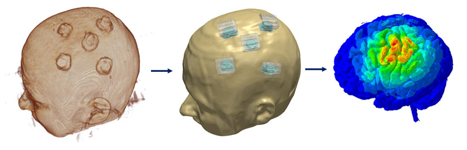 MRI/fMRI data integration in neurotargeting software