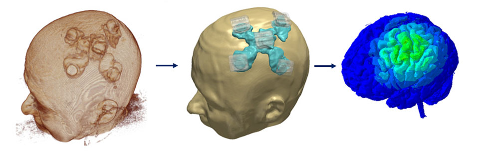 MRI/fMRI data integration in neurotargeting software