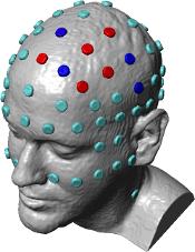 https://soterixmedical.com/static/images/hdimages/hd-tdcs_4-resized.png