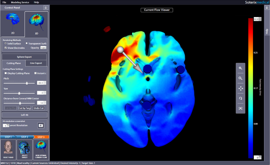 Interferential Neuromodulation and HD-Targets Software