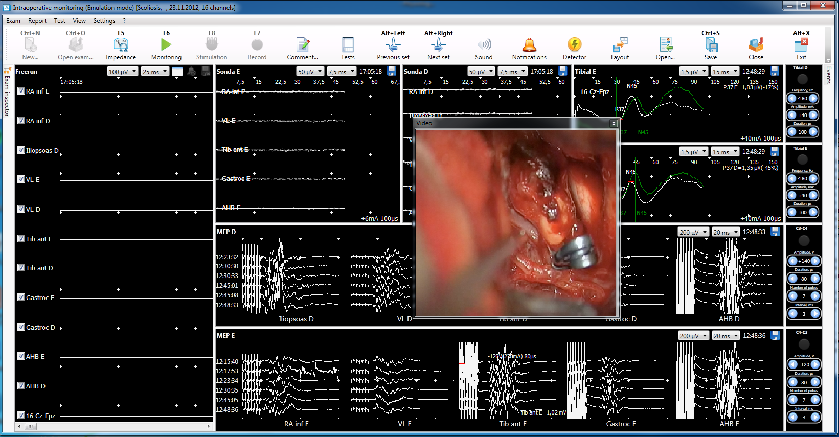 Image of Video Recording during surgery