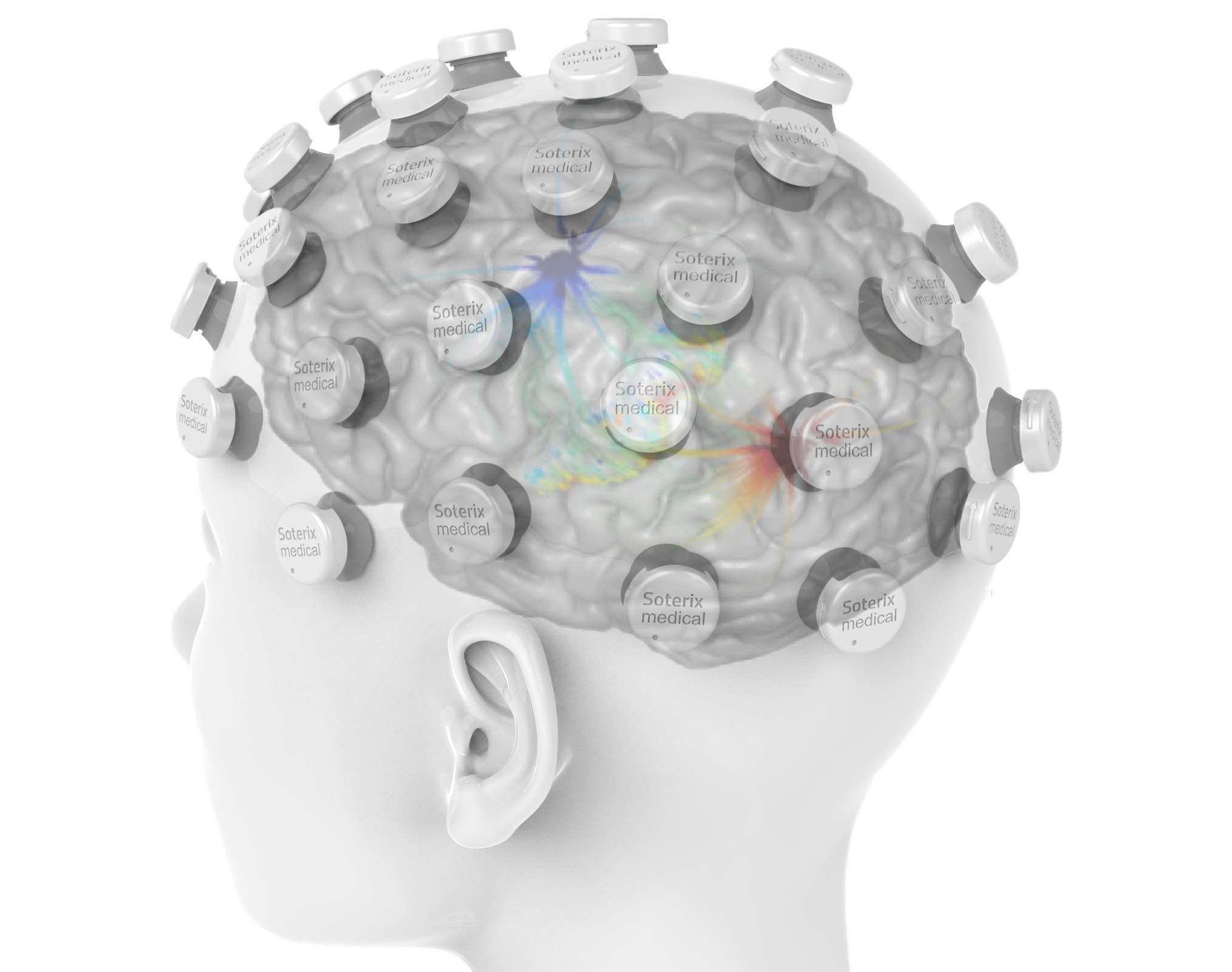 Soterix Medical - Neuromodulation and Brain Stimulation Technology