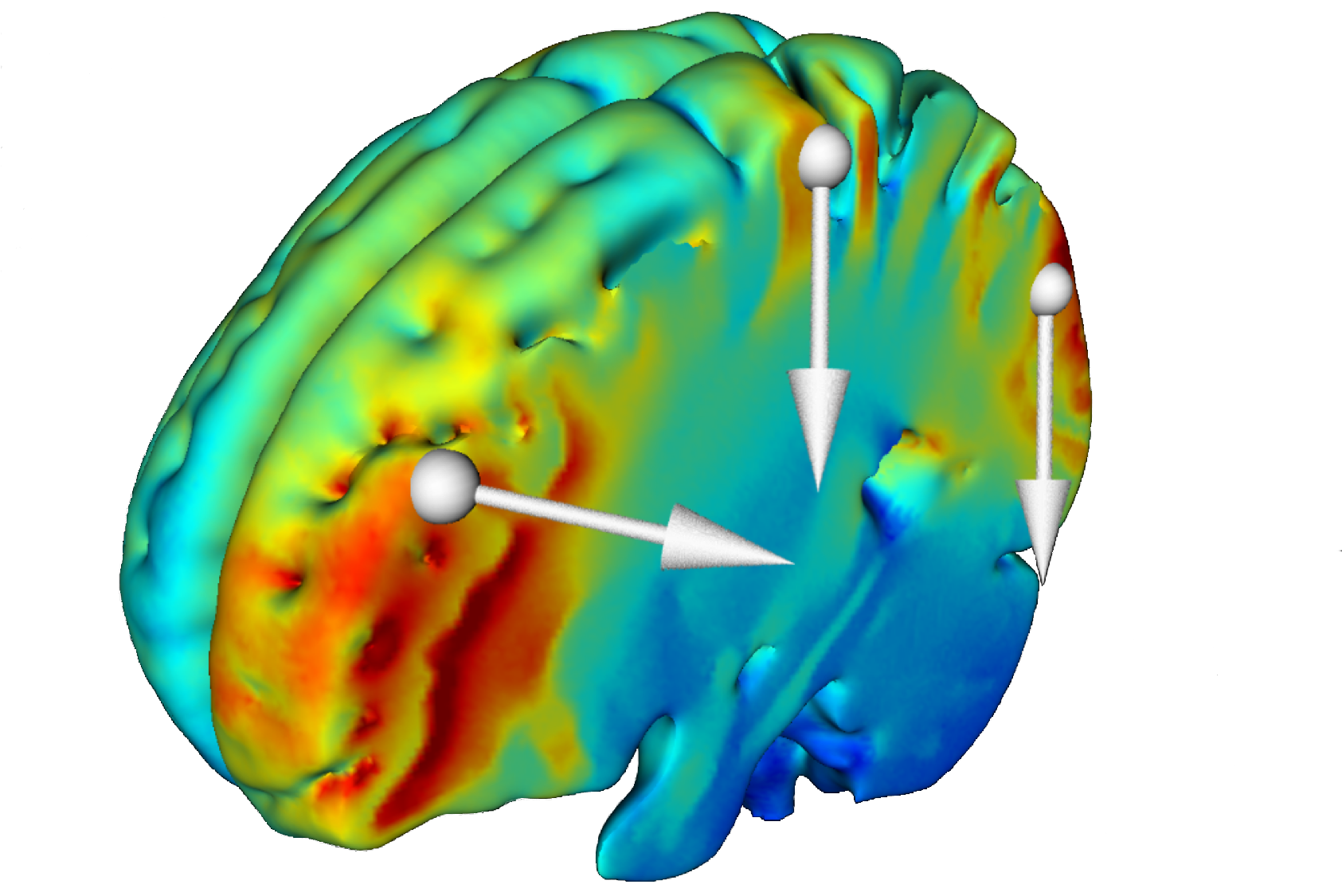 Soterix Medical - Neuromodulation and Brain Stimulation Technology