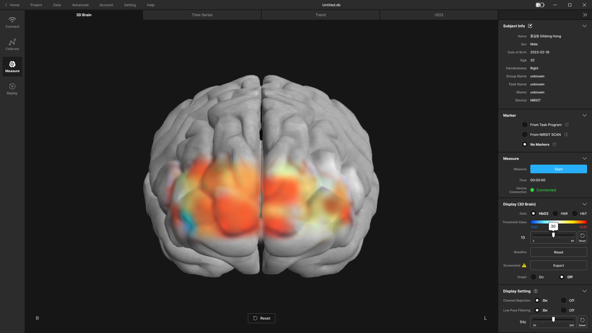 Soterix Medical functional NIRSIT Scan feature 3d brain