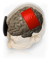 Soterix Medical - Neuromodulation and Brain Stimulation Technology