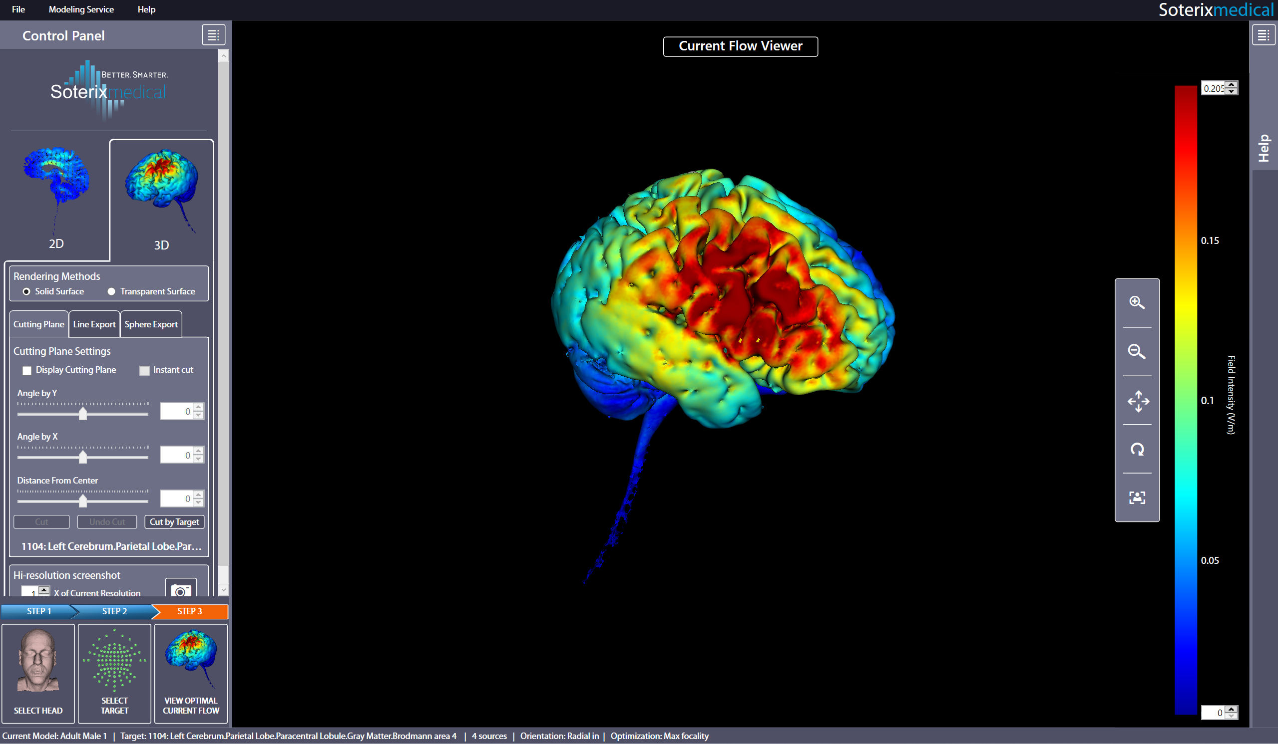 Soterix Medical - Neuromodulation and Brain Stimulation Technology