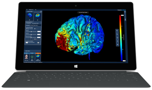 Soterix Medical HD-tES+ EEG Webinar
