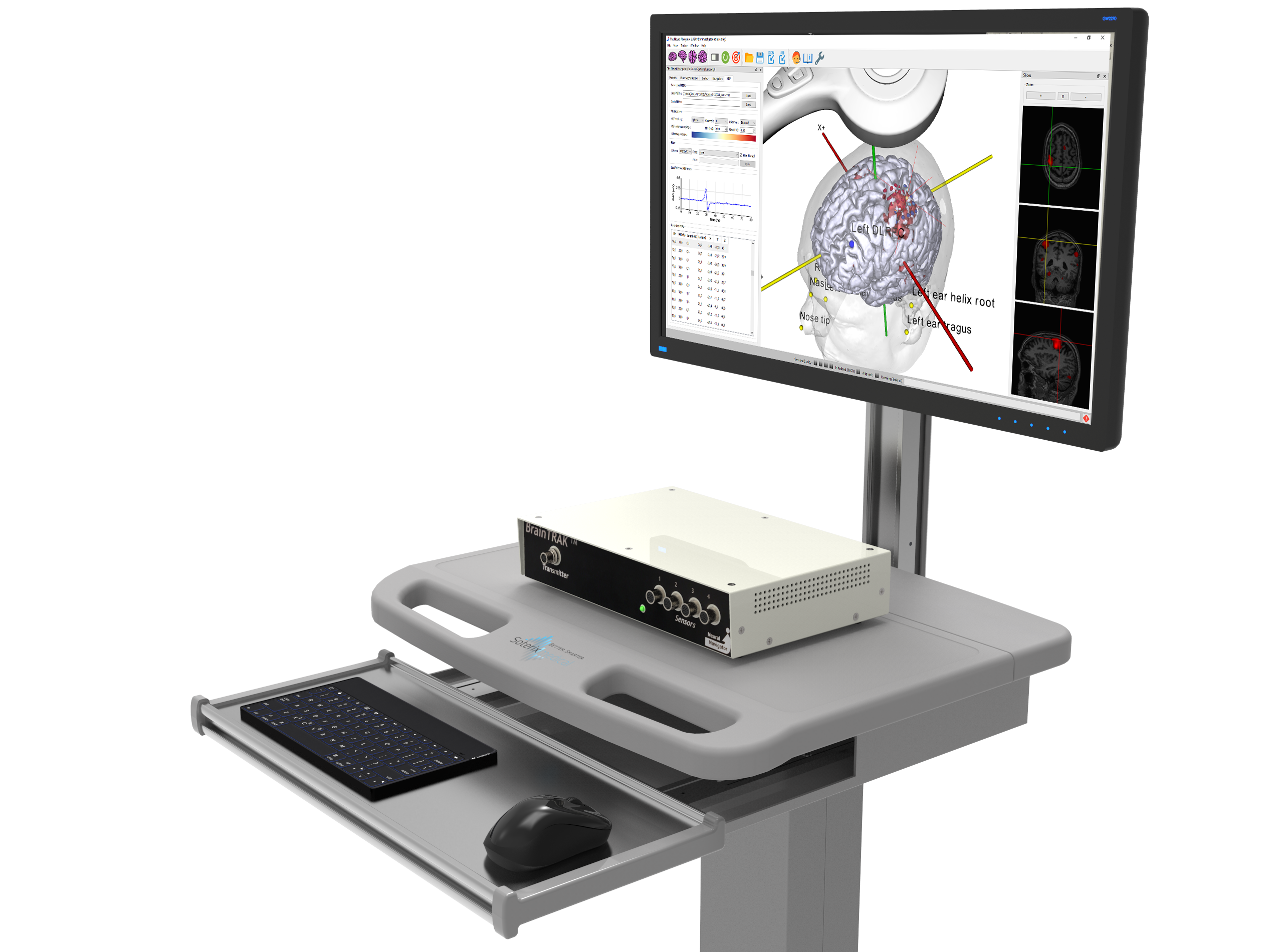 Soterix Medical Neuronavigation webinar